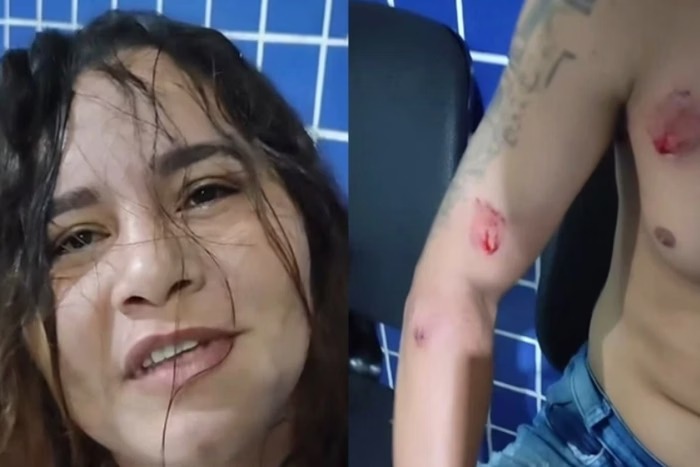Mulher surta ao flagrar traição e ataca marido e amante a dentadas, no PI