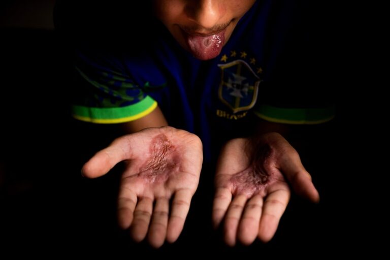 Mãe de santo torturava adolescentes com pauladas, cortes e queimaduras