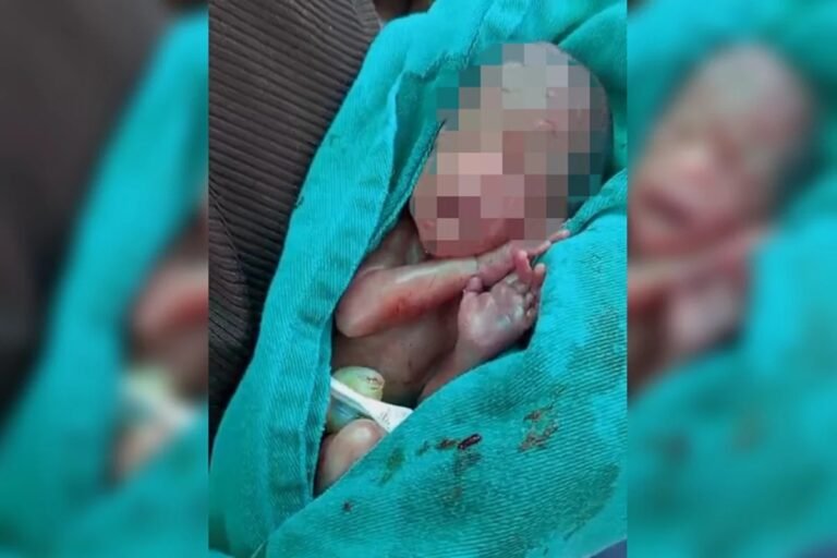 PREMATURO EXTREMO – Bebê que chorou durante enterro morre no hospital