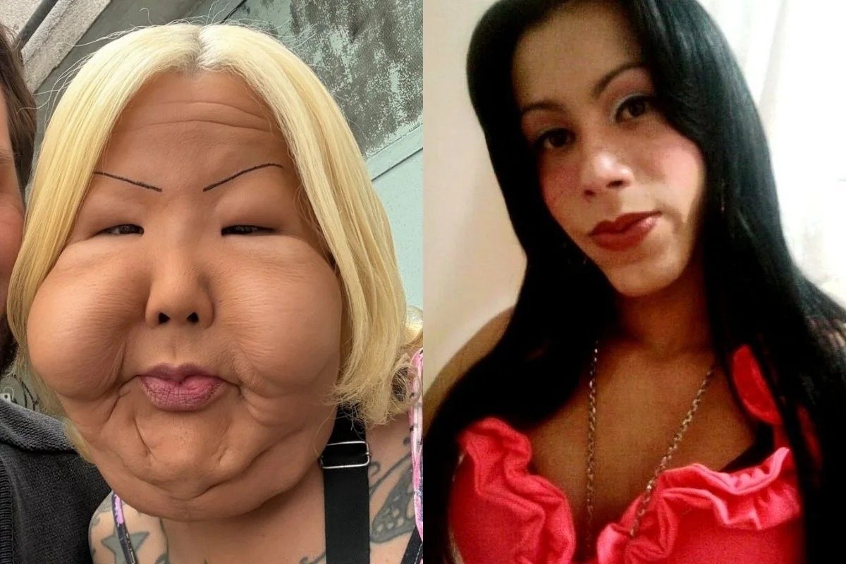 Juju do Pix mostra como ficou o rosto um mês após retirar óleo mineral