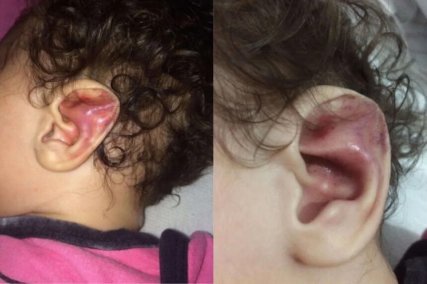 Mãe foragida por torturar e quebrar 6 costelas de filha bebê é presa 1 Mãe foragida por torturar e quebrar 6 costelas de filha bebê é presa