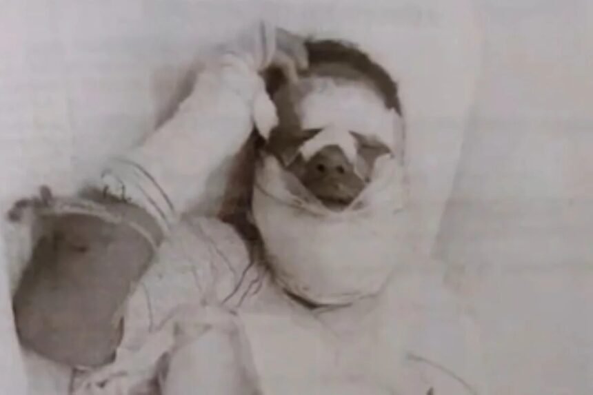 Após briga, homem joga álcool e ateia fogo no rosto de companheira