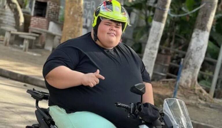 Gordão da XJ perde 130 kg e reavalia bariátrica: veja antes e depois