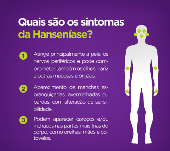 Campanha Janeiro Roxo reforça enfrentamento à hanseníase e alerta para diagnóstico precoce em Rondônia