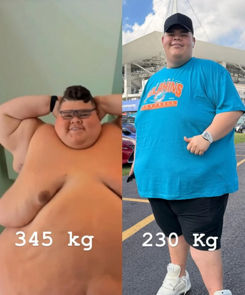 Gordão da XJ perde 130 kg e reavalia bariátrica: veja antes e depois