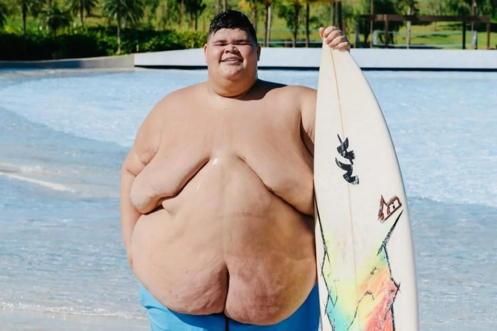 Gordão da XJ perde 130 kg e reavalia bariátrica: veja antes e depois