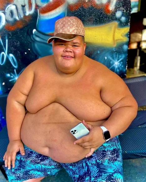 Gordão da XJ perde 130 kg e reavalia bariátrica: veja antes e depois