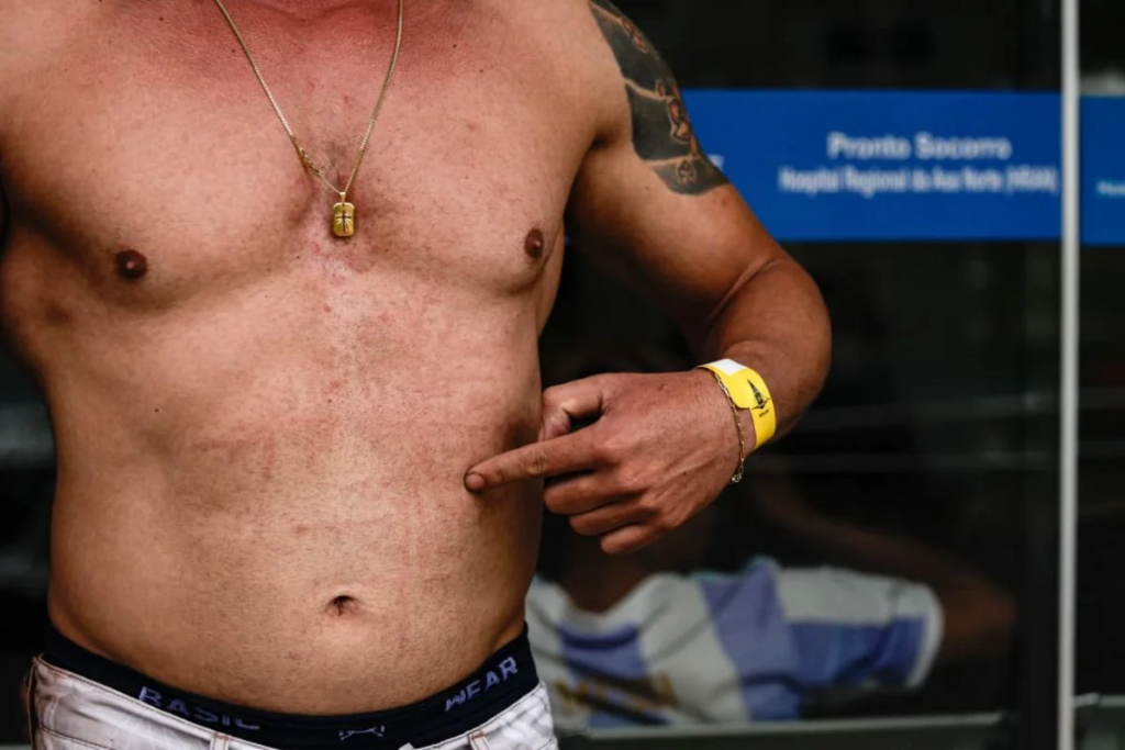 Raio em ato de Nikolas: ao menos 4 seguem internados em hospital do DF - VEJA FOTOS