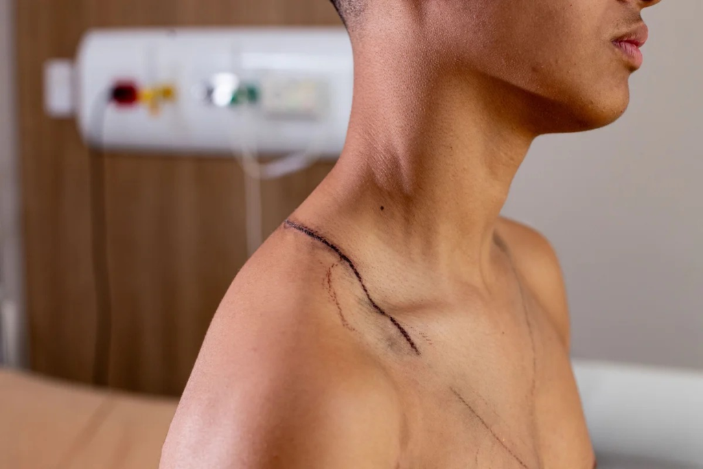 Raio em ato de Nikolas: jovem que teve as costas rasgadas recebe alta - VEJA AS FOTOS