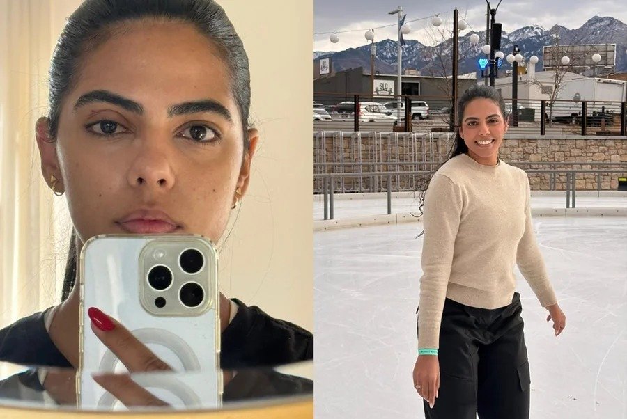 Jovem perde parte da visão após meses ignorando sinais de glaucoma