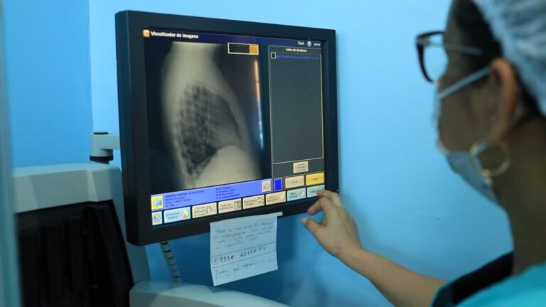 Prefeitura alerta para prevenção e tratamento da tuberculose