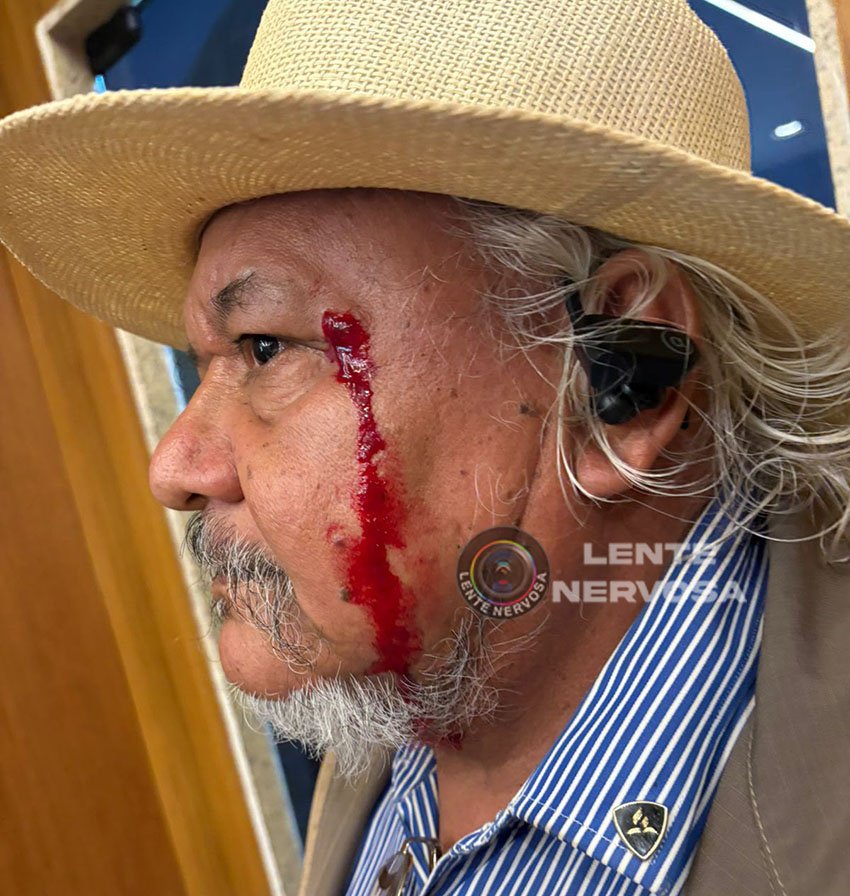 Assessor de 72 anos é agredido por ativista e fica ensanguentado em confusão na Câmara de Porto Velho 2 Assessor de 72 anos é agredido por ativista e fica ensanguentado em confusão na Câmara de Porto Velho