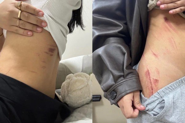 Casal lésbico narra momentos de horror durante estupro: “Queria o nosso desespero”