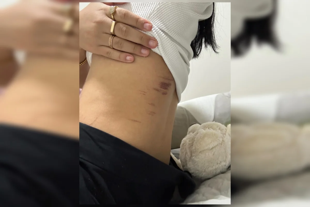Casal lésbico narra momentos de horror durante estupro: "Queria o nosso desespero" 3 Casal lésbico narra momentos de horror durante estupro: "Queria o nosso desespero"