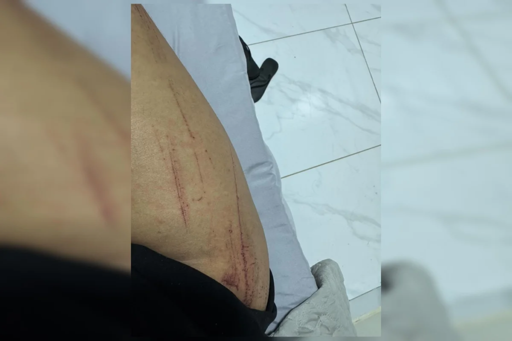 Casal lésbico narra momentos de horror durante estupro: "Queria o nosso desespero" 4 Casal lésbico narra momentos de horror durante estupro: "Queria o nosso desespero"
