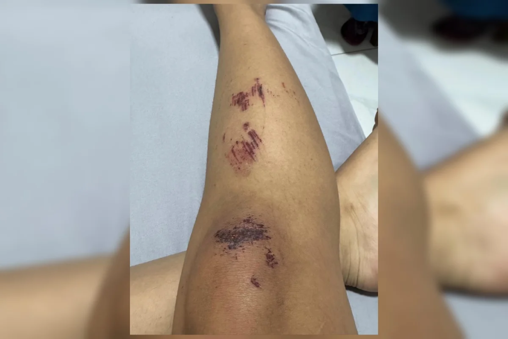 Casal lésbico narra momentos de horror durante estupro: "Queria o nosso desespero" 5 Casal lésbico narra momentos de horror durante estupro: "Queria o nosso desespero"