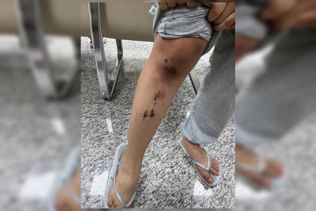 Casal lésbico narra momentos de horror durante estupro: "Queria o nosso desespero" 8 Casal lésbico narra momentos de horror durante estupro: "Queria o nosso desespero"