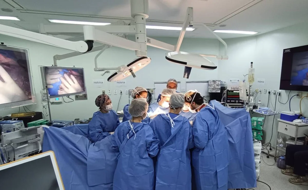 Gêmeas siamesas unidas pela cabeça morrem em cirurgia de separação 2 Gêmeas siamesas unidas pela cabeça morrem em cirurgia de separação