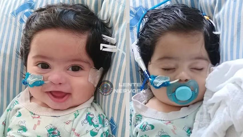 Bebê de 4 meses morre após leite ser injetado em acesso de medicação em hospital de Pernambuco 1 Bebê de 4 meses morre após leite ser injetado em acesso de medicação em hospital de Pernambuco