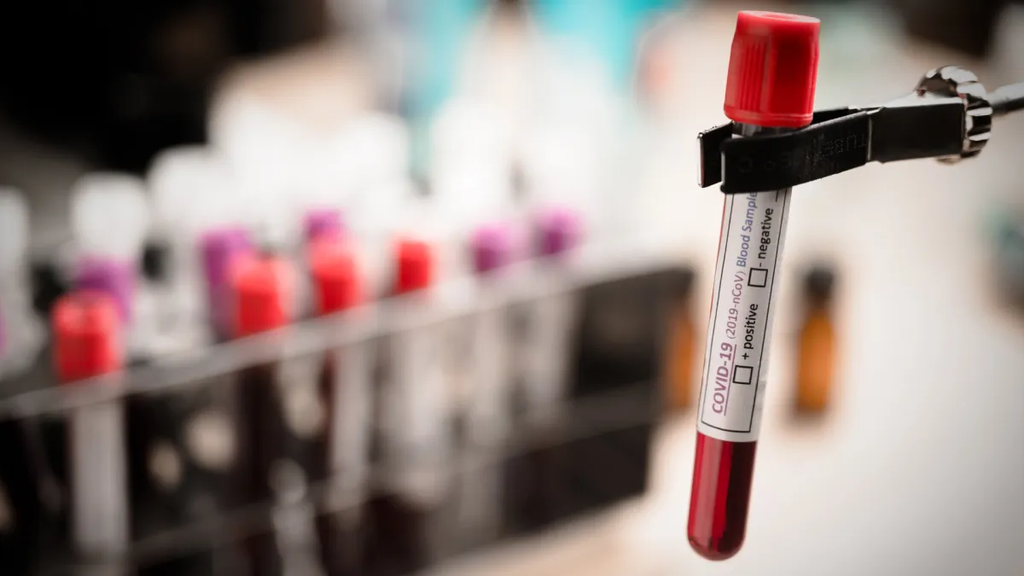Exame de sangue que detecta mais de 50 tipos de câncer chega ao Brasil